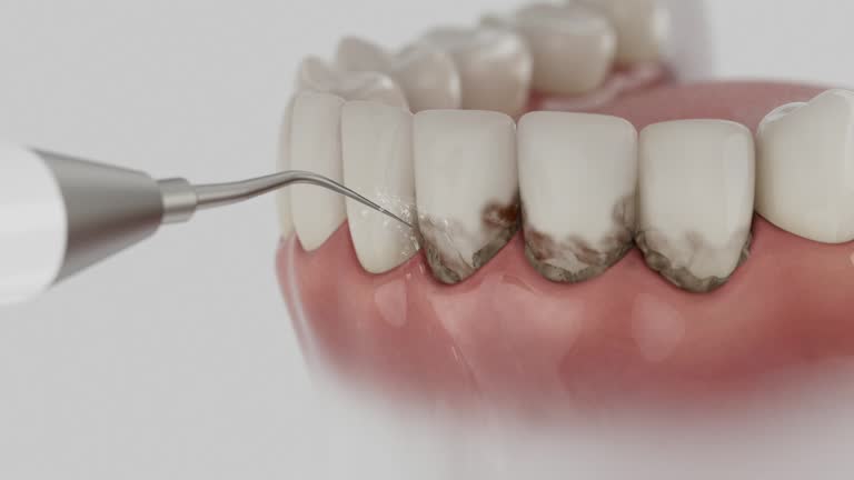 Reliable Tooth Extraction contractor in Eagan, MN by Smile Center Dentistry
